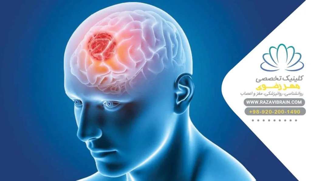 نوروفیدبک در مشهد