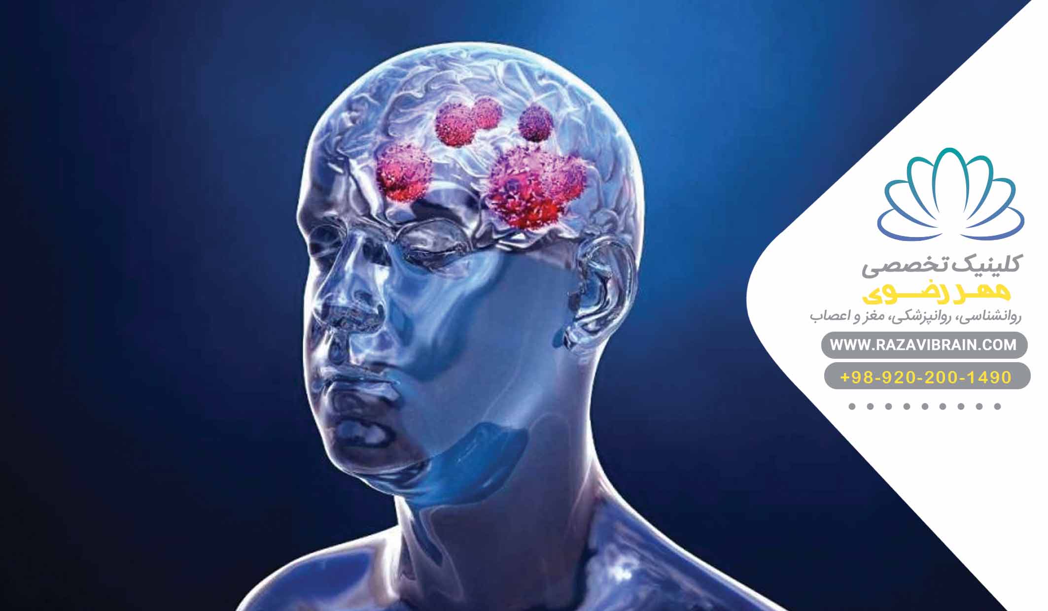 چه افرادی در باشگاه مغز کلینیک مهر رضوی می توانند شرکت کنند؟
