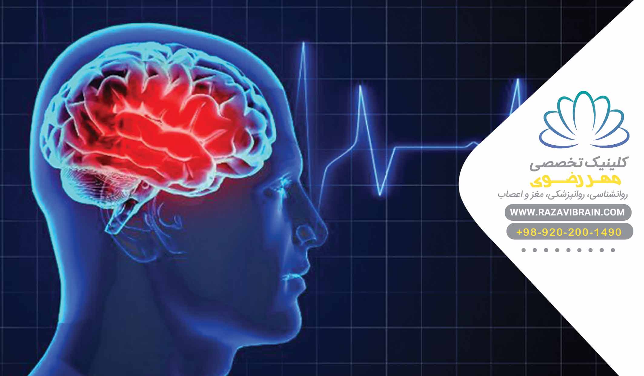 بیماری‌های جراحی مغز و اعصاب