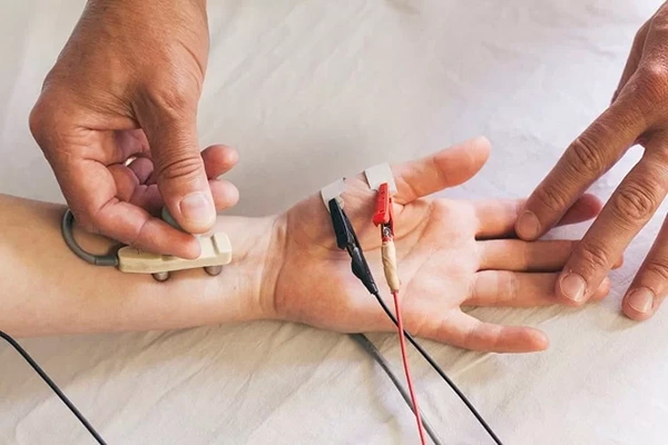 نوار عصب و عضله (EMG – NCV)