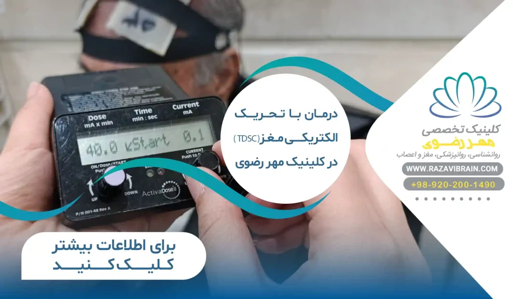 تحریک الکتریکی مغز TDCS