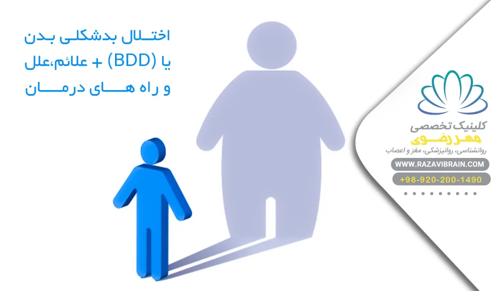 اختلال بدشکلی بدن