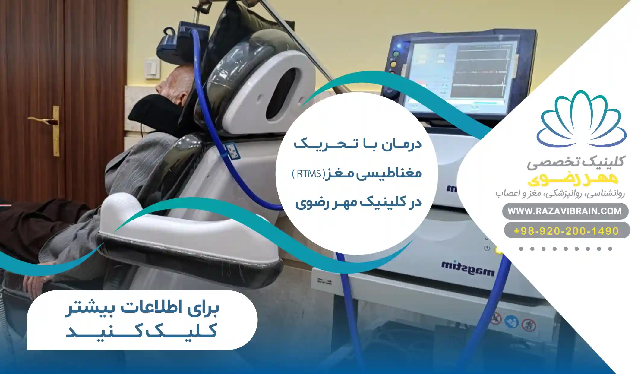 درمان rTMS (آر تی ام اس)