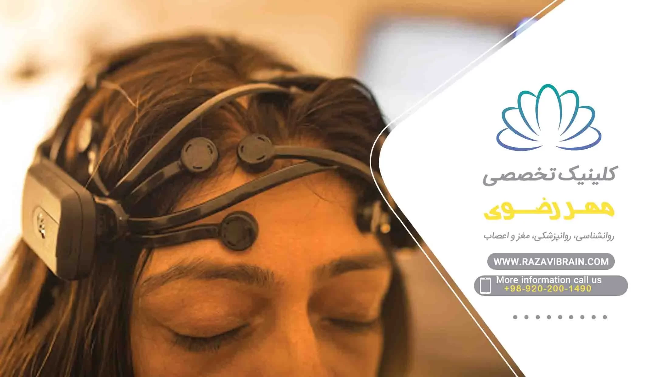 TDCS مزایای درمان اضطراب با تحریک الکتریکی مغز tdcs