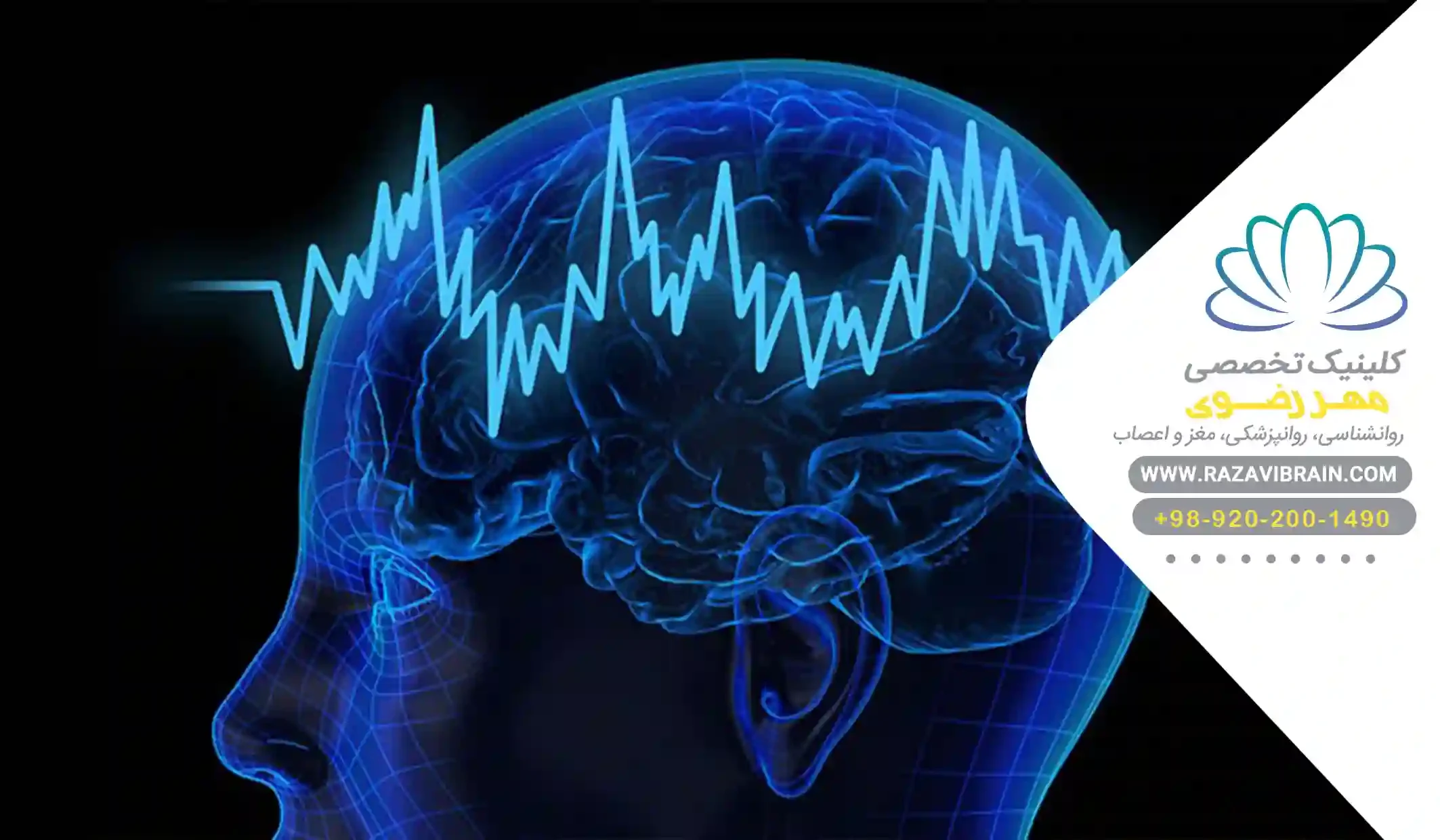 Types of brain waves and their effects on the brain تاثیر انواع امواج مغزی برای اختلالات روانشناختی